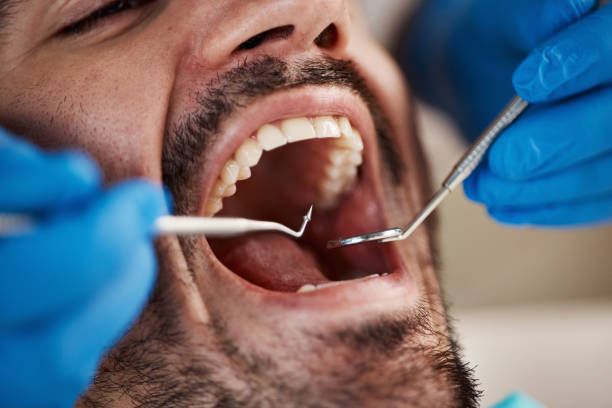 Best Emergency Treatment for Dental Infections or Abscesses in Clarkdale, AZ